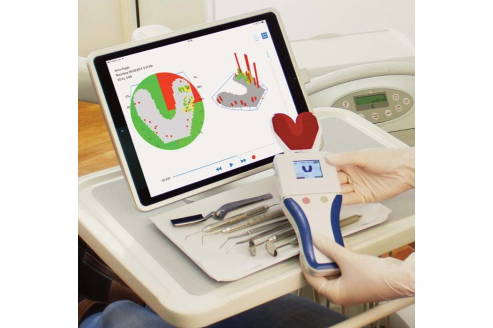 デジタル咬合分析システム